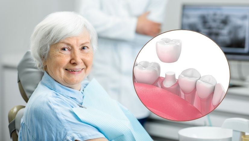 Natural Smile with Tooth-Colored Fillings