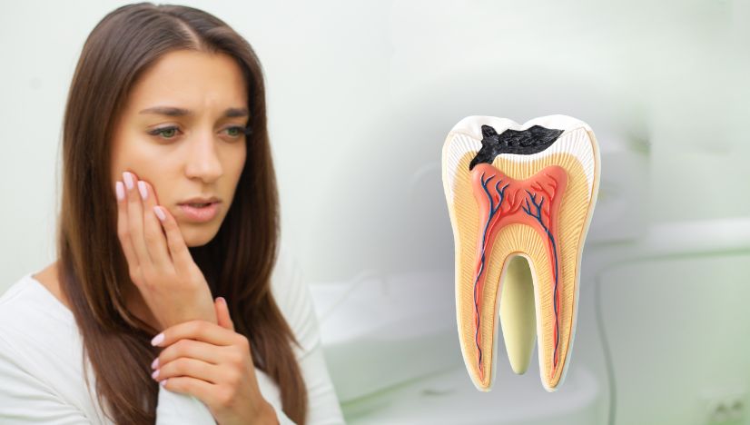 Natural Smile with Tooth-Colored Fillings