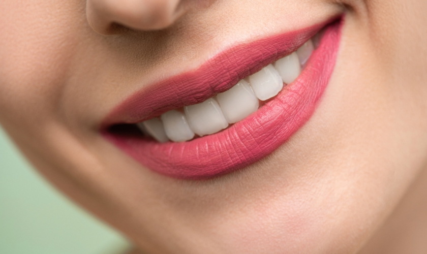 Natural Smile with Tooth-Colored Fillings