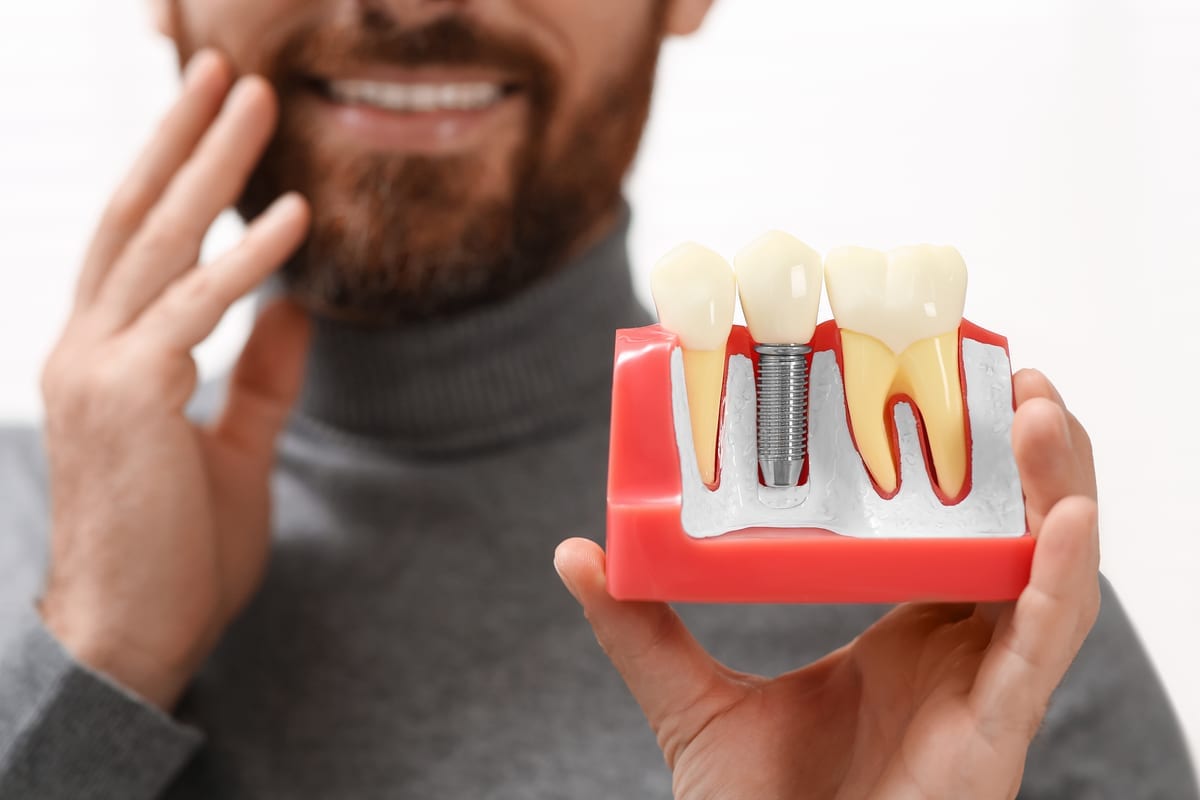 Dental Implants in Sykesville